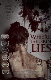 Where the Skin Lies poster
