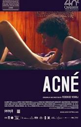 Acne poster