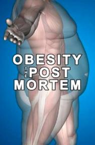 Obesity: The Post Mortem poster