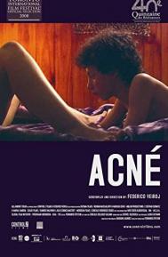 Acne poster